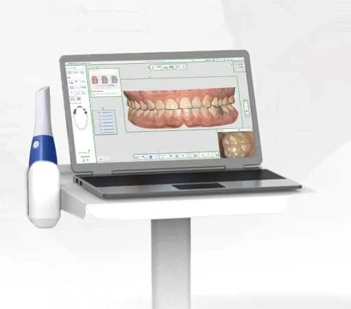 Medit i600 intraoral scanner with laptop